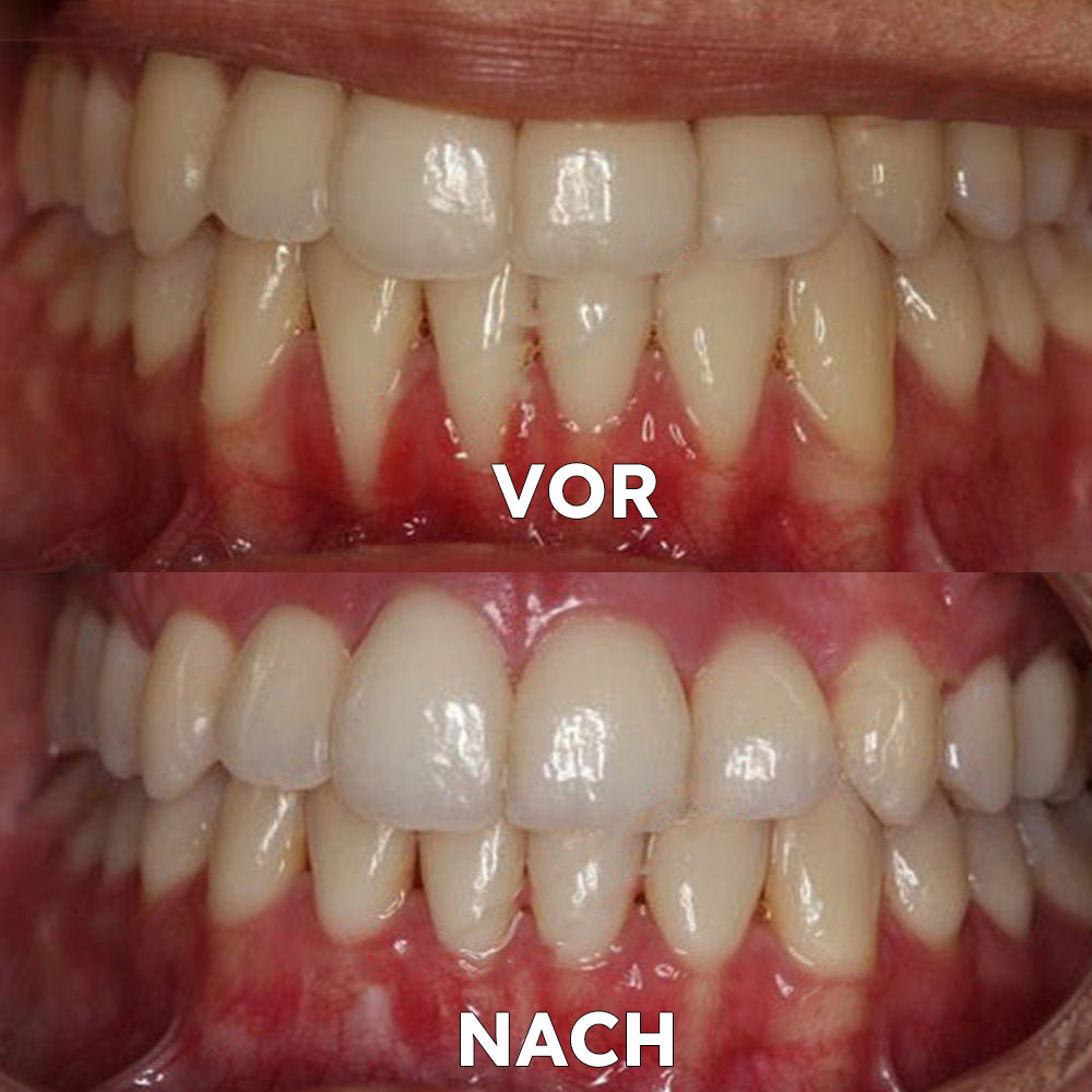 FrischeAura | Kokosöl-Mundspülung für frischen Atem und antibakterielle Wirkung