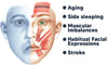 EMSculpt Schlafen V-Gesicht Schönheit Gerät